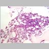 Medula osea HE 02.jpg